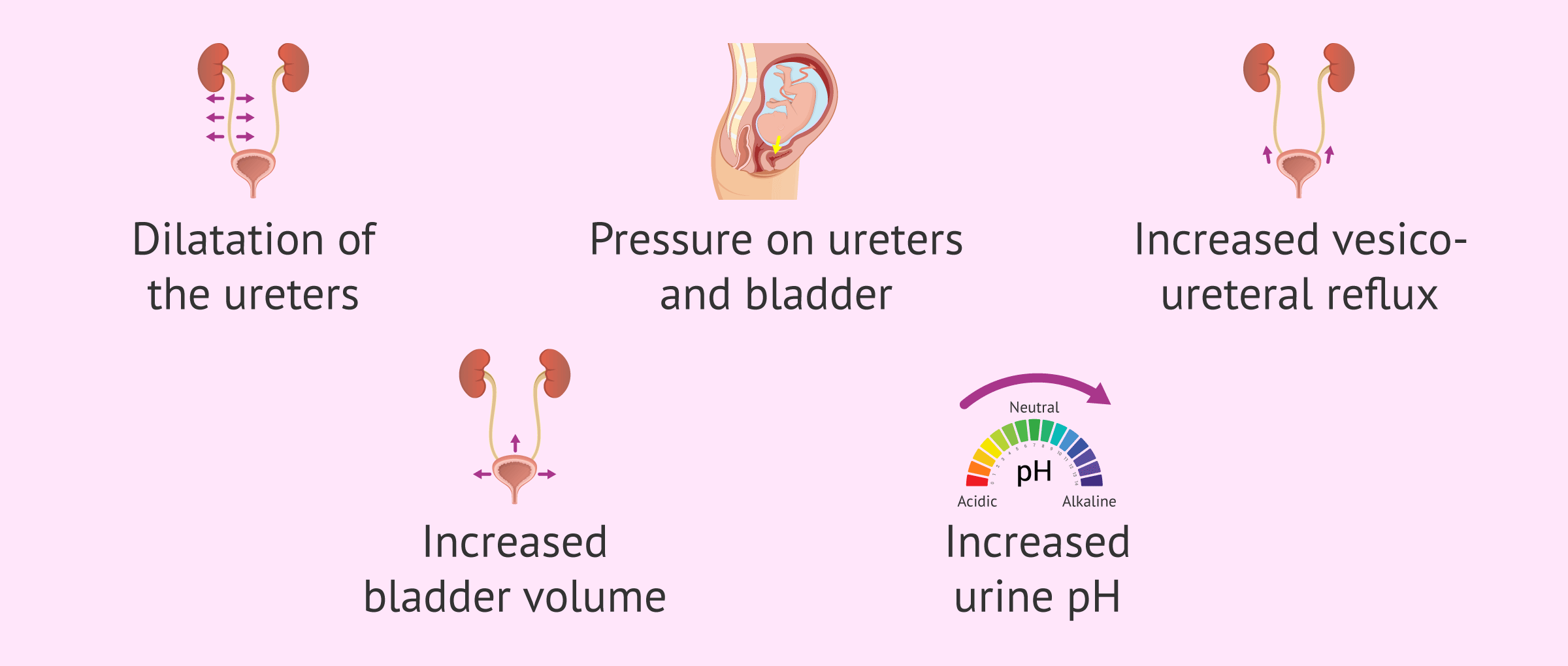 Why are urinary tract infections so common in pregnancy?