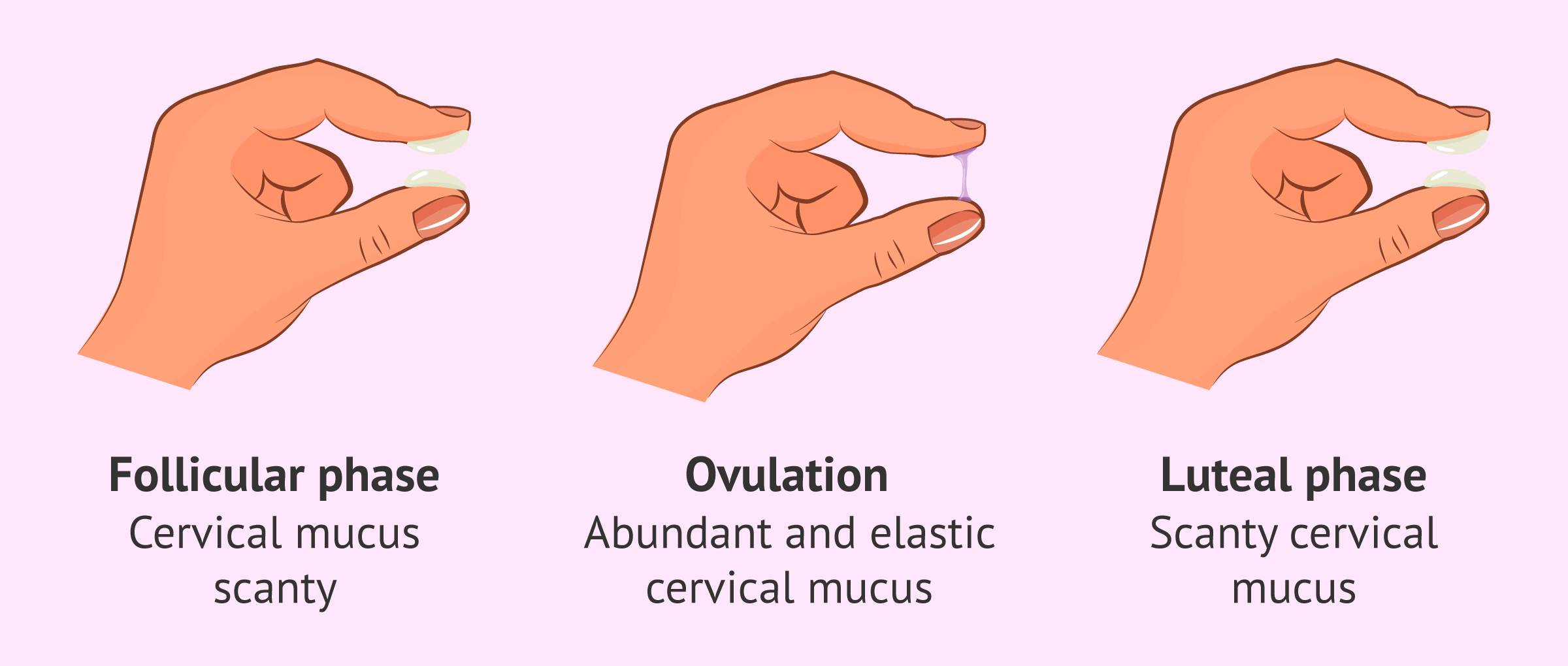 Normal variations of cervical mucus