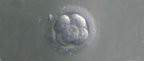 Embryo quality