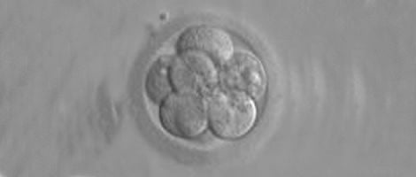Grade-III-embryos