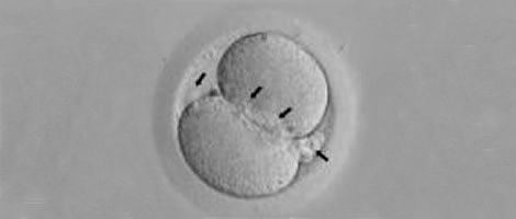 Grade II embryos