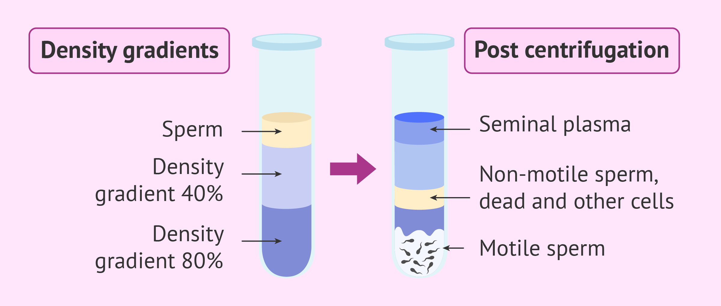 Sperm Capacitation