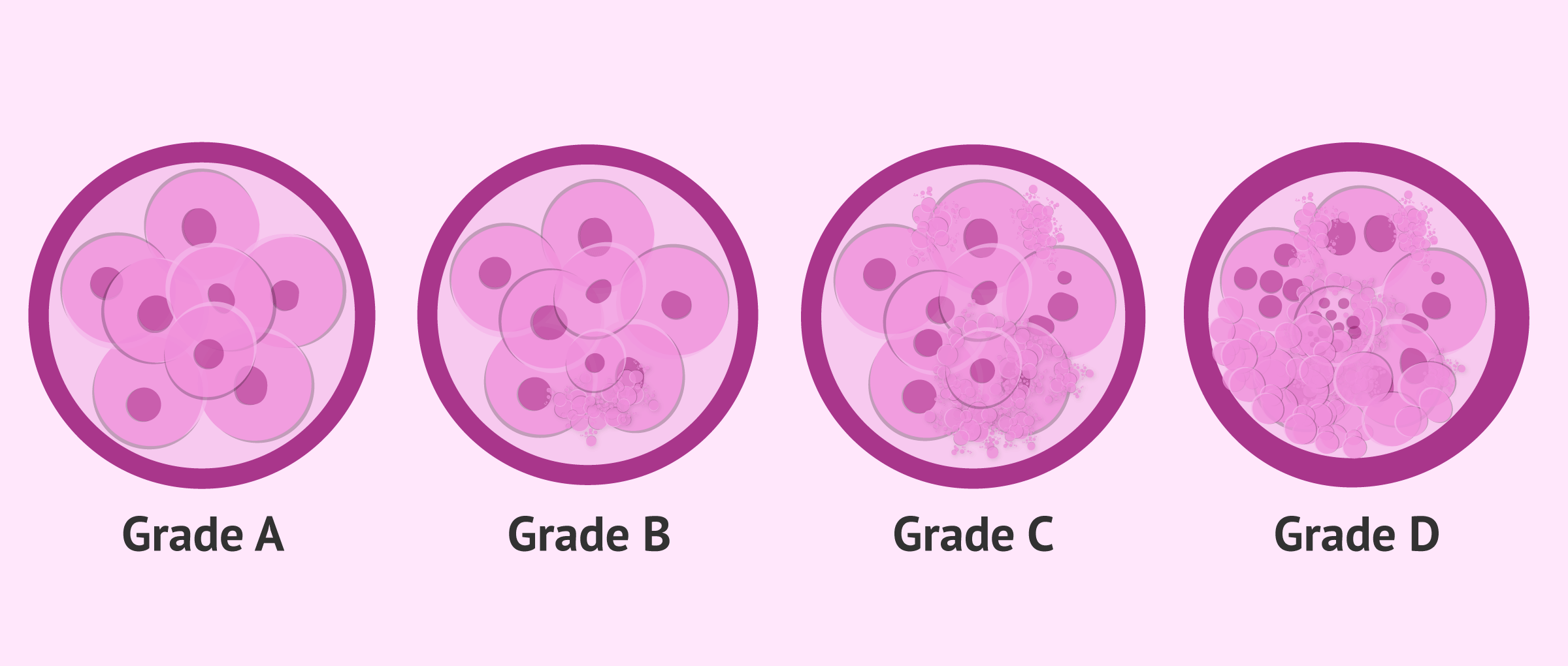 Imagen: Embryos in IVF are classified according to their quality