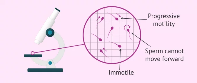 Sperm motility analysis