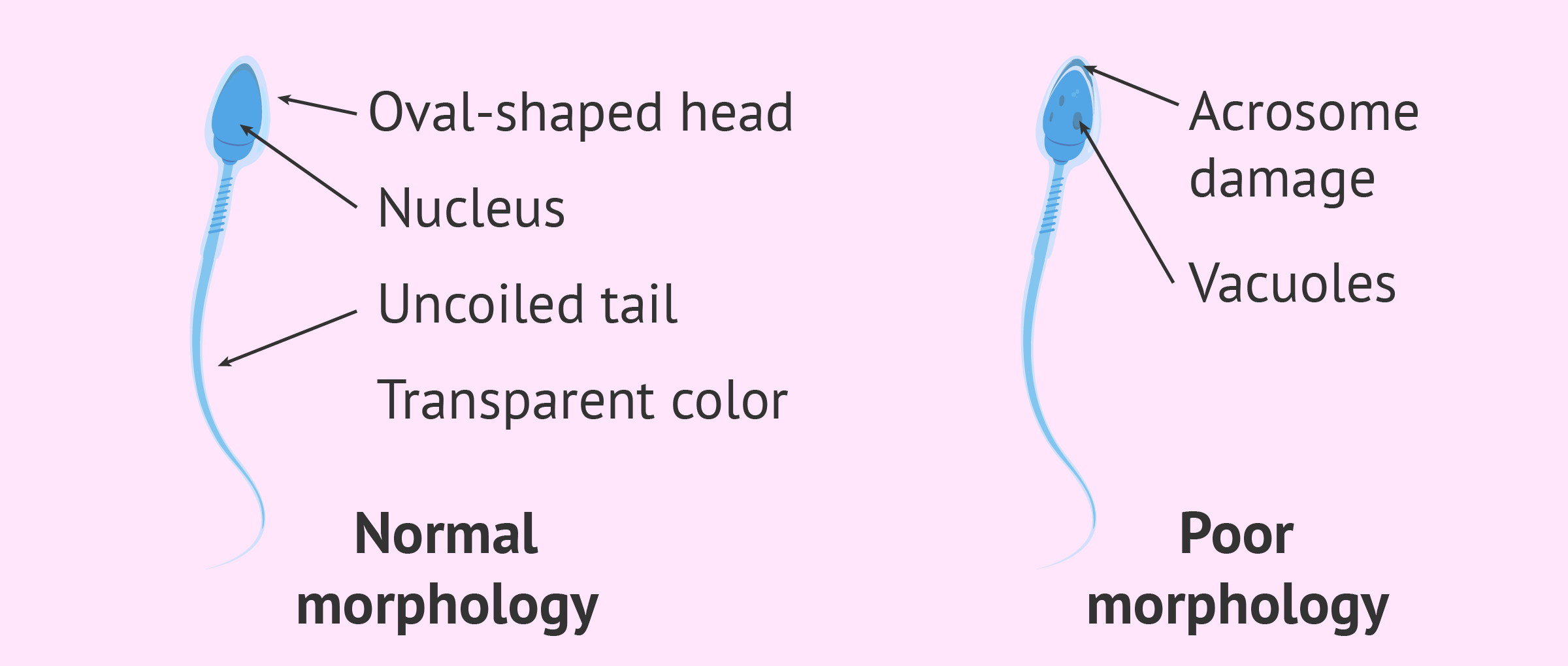 Characteristics of normal sperm morphology