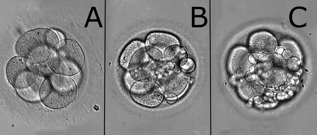 Embryo classification