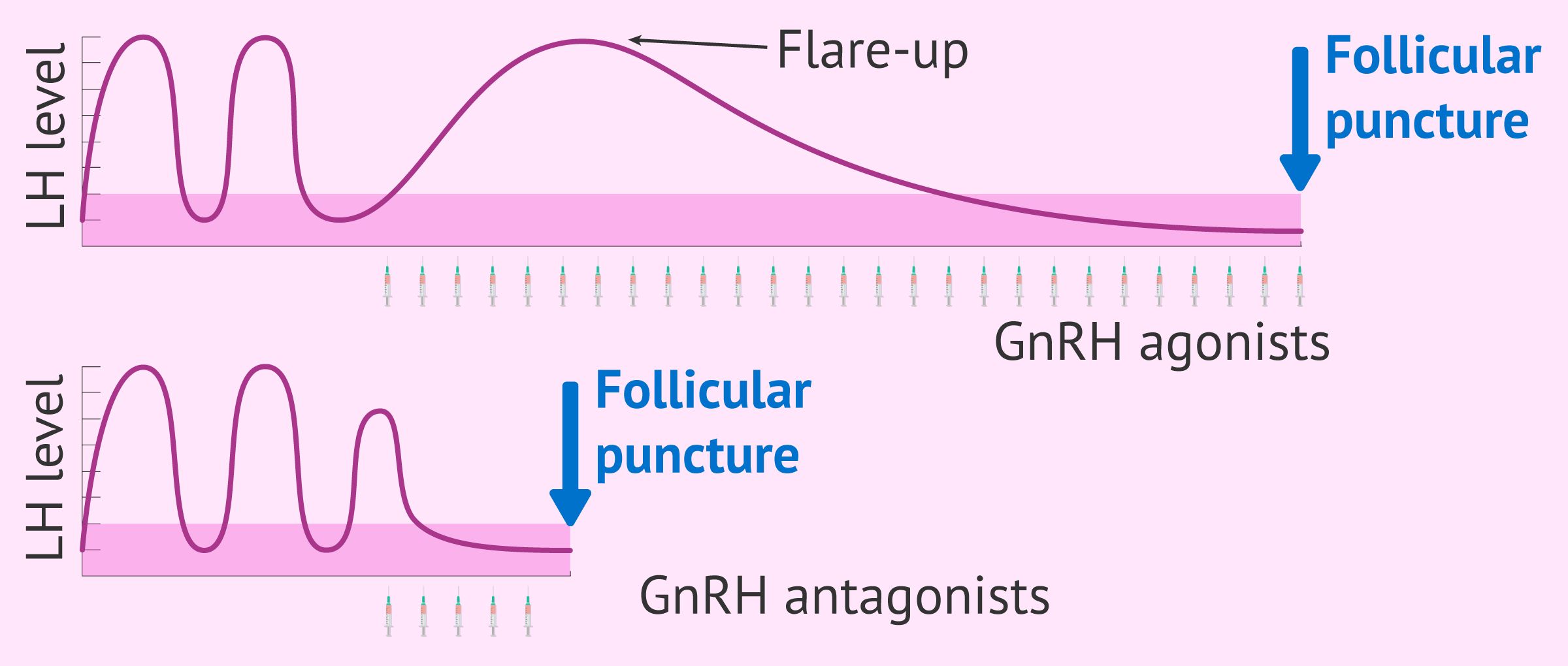 What Is A Short IVF Protocol With GnRH Antagonists 