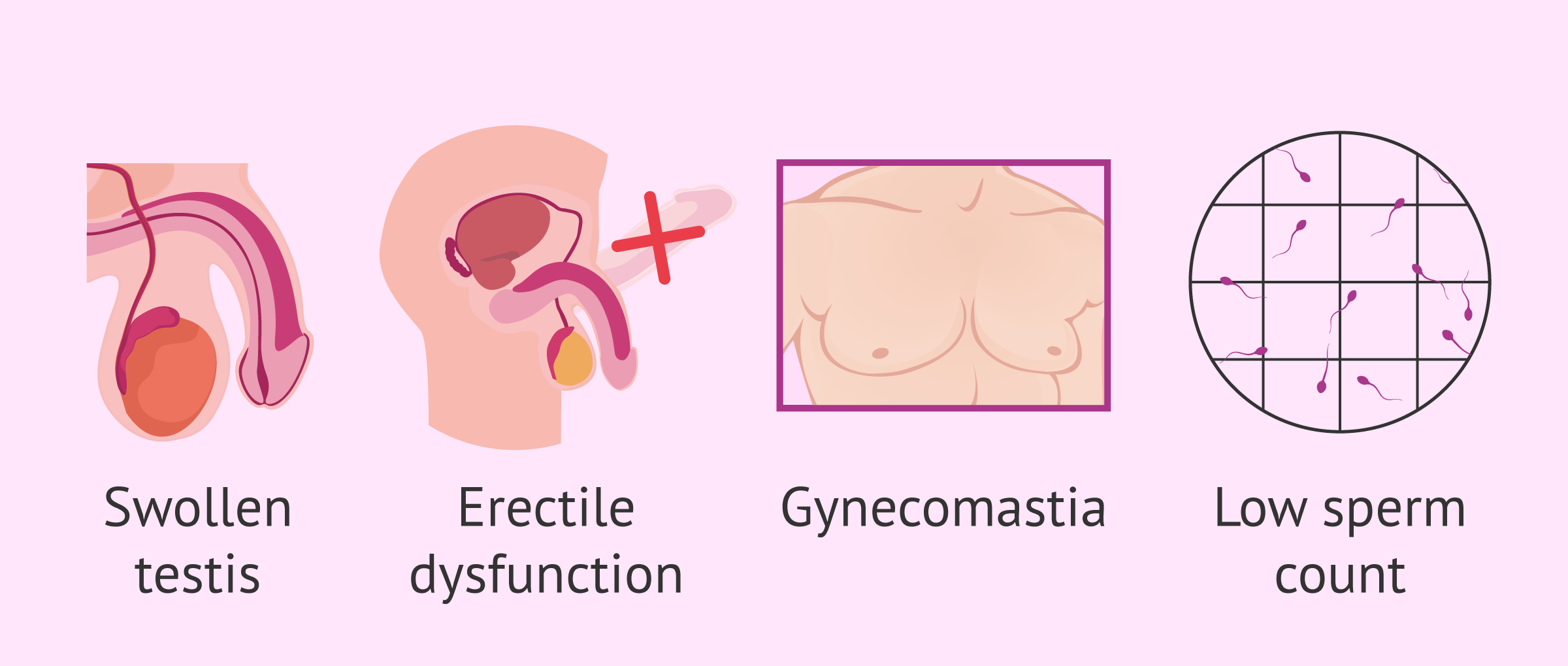 Symptoms of infertility in males