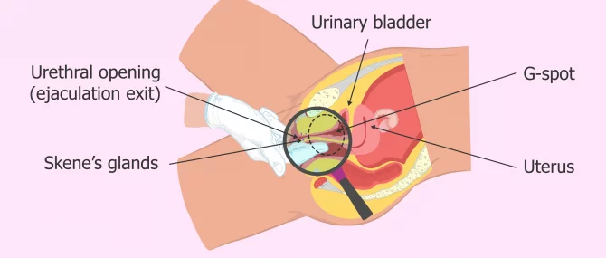 Female Ejaculation After Hysterectomy