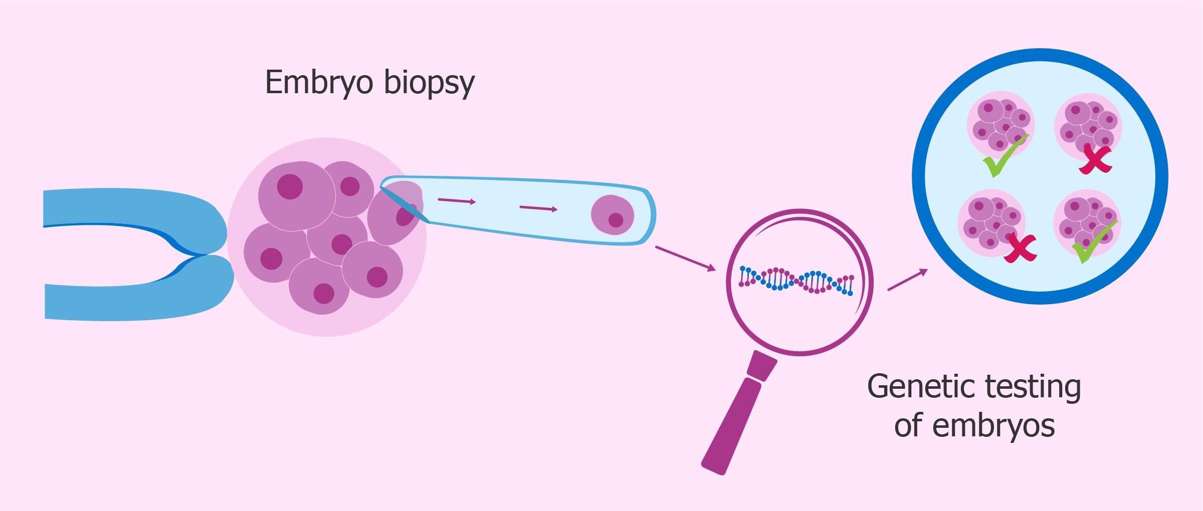 Preimplantation Testing for Abnormal Embryos