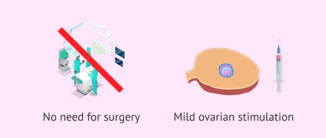 Imagen: Advantages of AI due to its simplicity