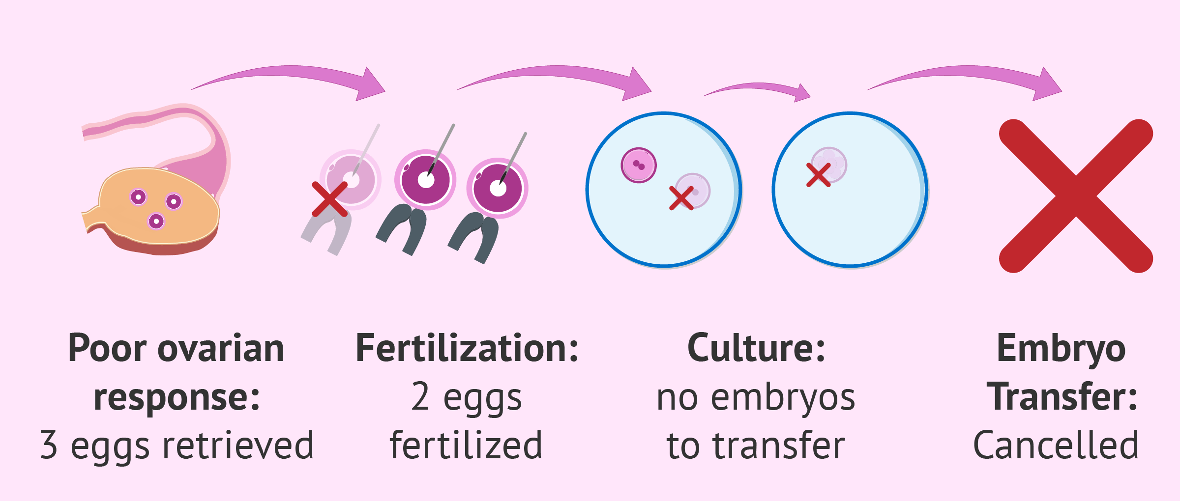 Cancellation of IVF cycles for poor ovarian response