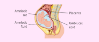 What Does Leaking Amniotic Fluid Feel Like? - Signs & Causes