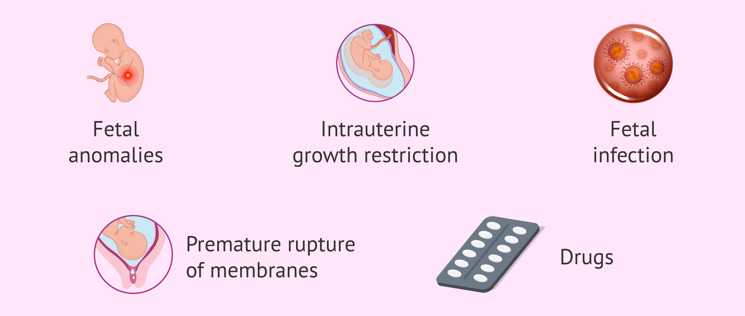 Imagen: Causes of oligohydramnios