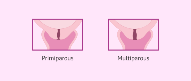 Imagen: Cervix in first and future pregnancies