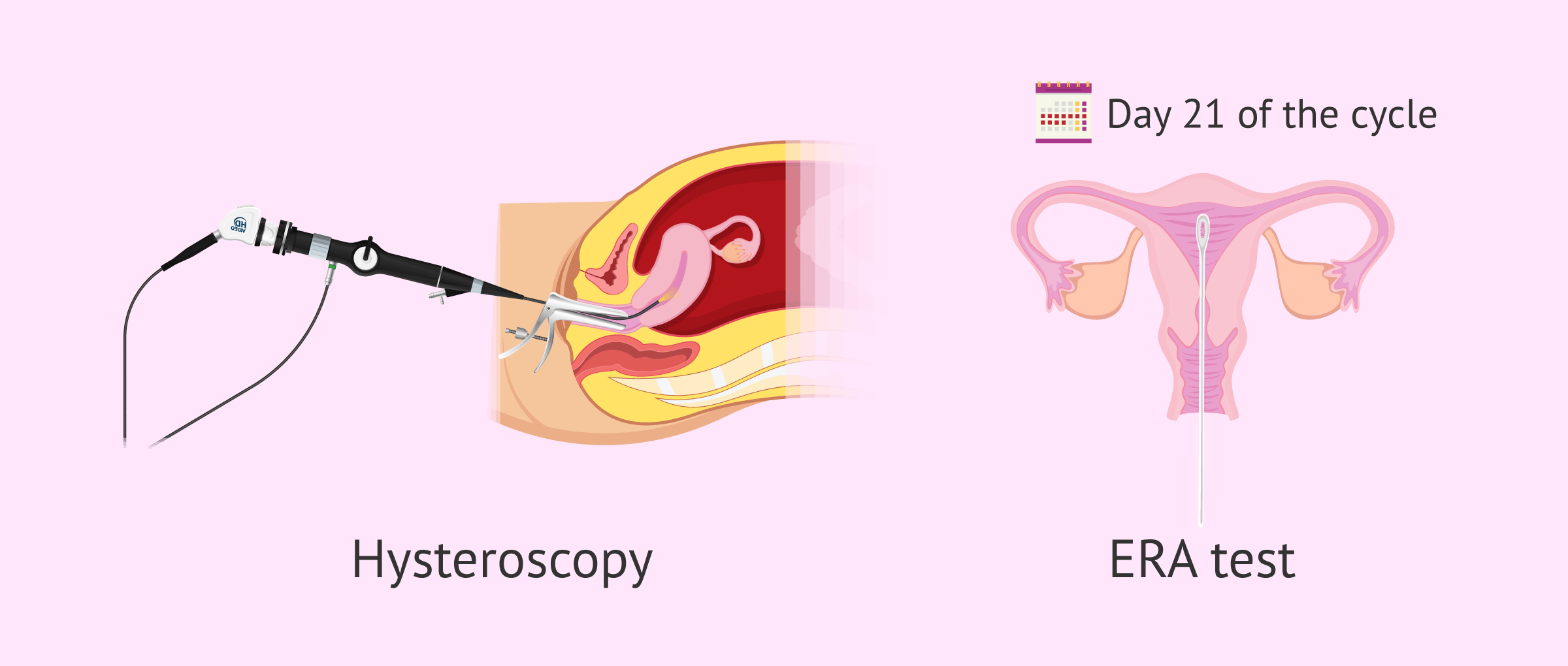 Complementary techniques to study the endometrium