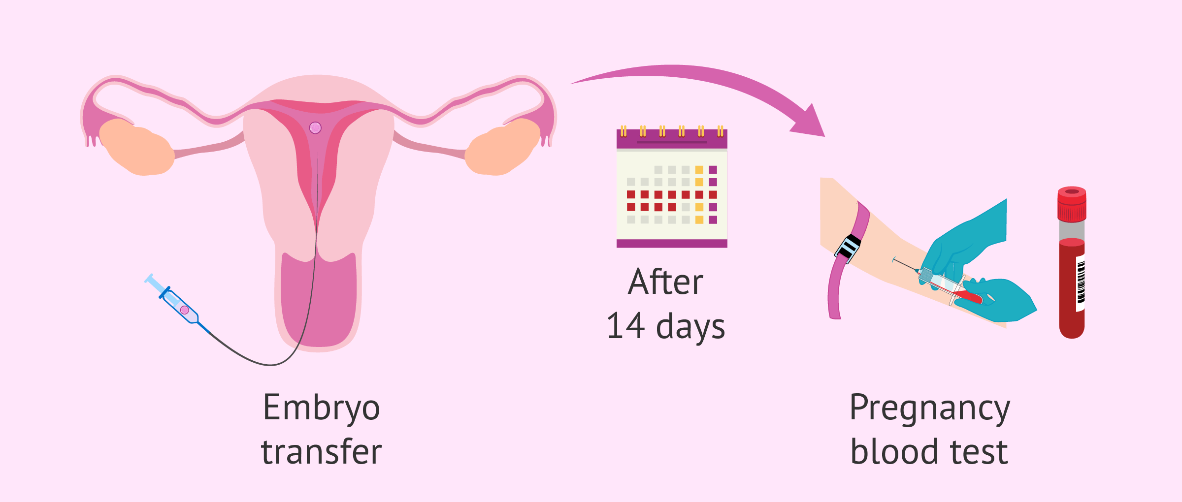 When to take a pregnancy test after IVF?