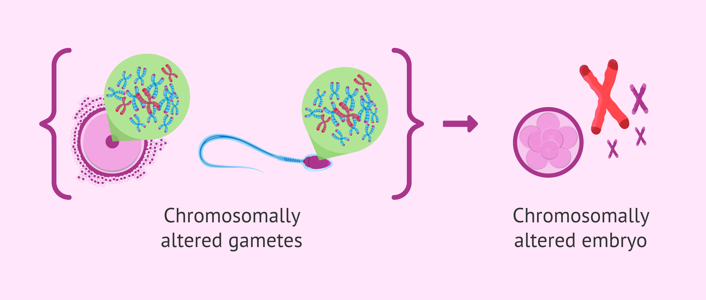 Imagen: Genetic alterations as a cause of miscarriage