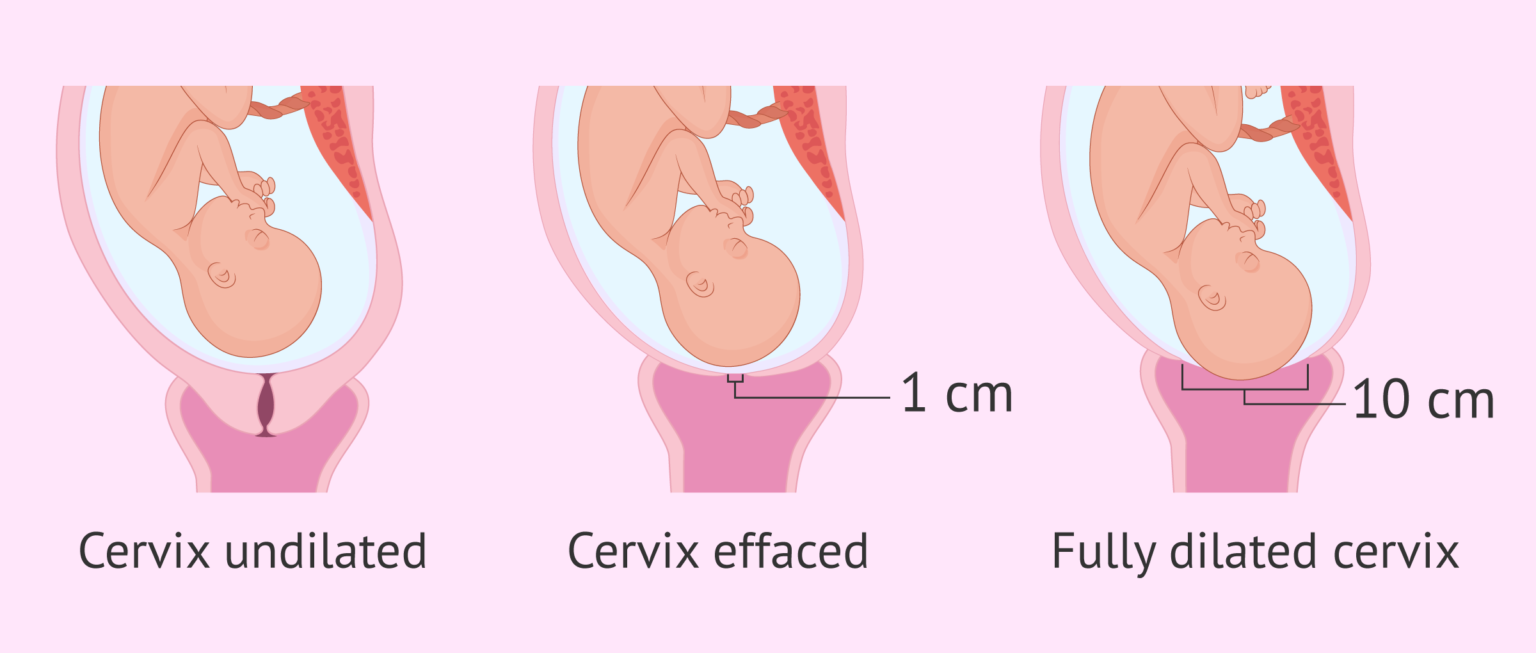 Changes and position of the cervix during pregnancy