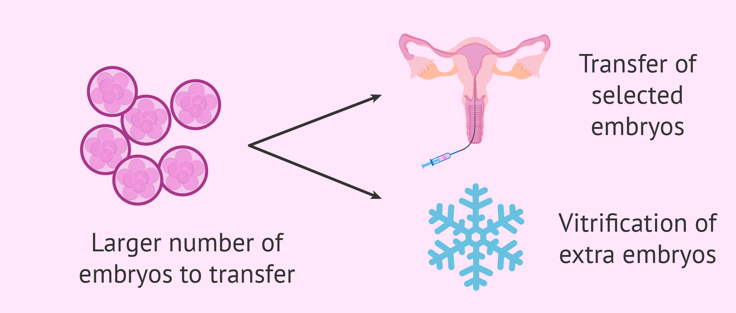 Pros of day 3 embryo transfers