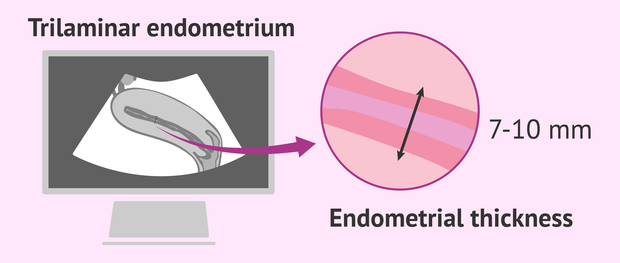 Ultrasound to see the endometrium