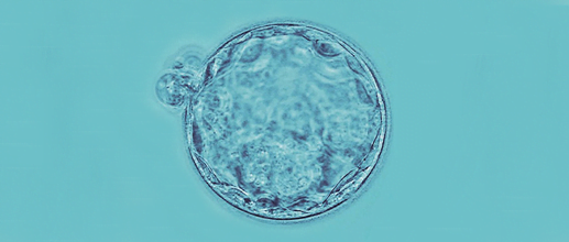 Day 5-6 of embryo culture
