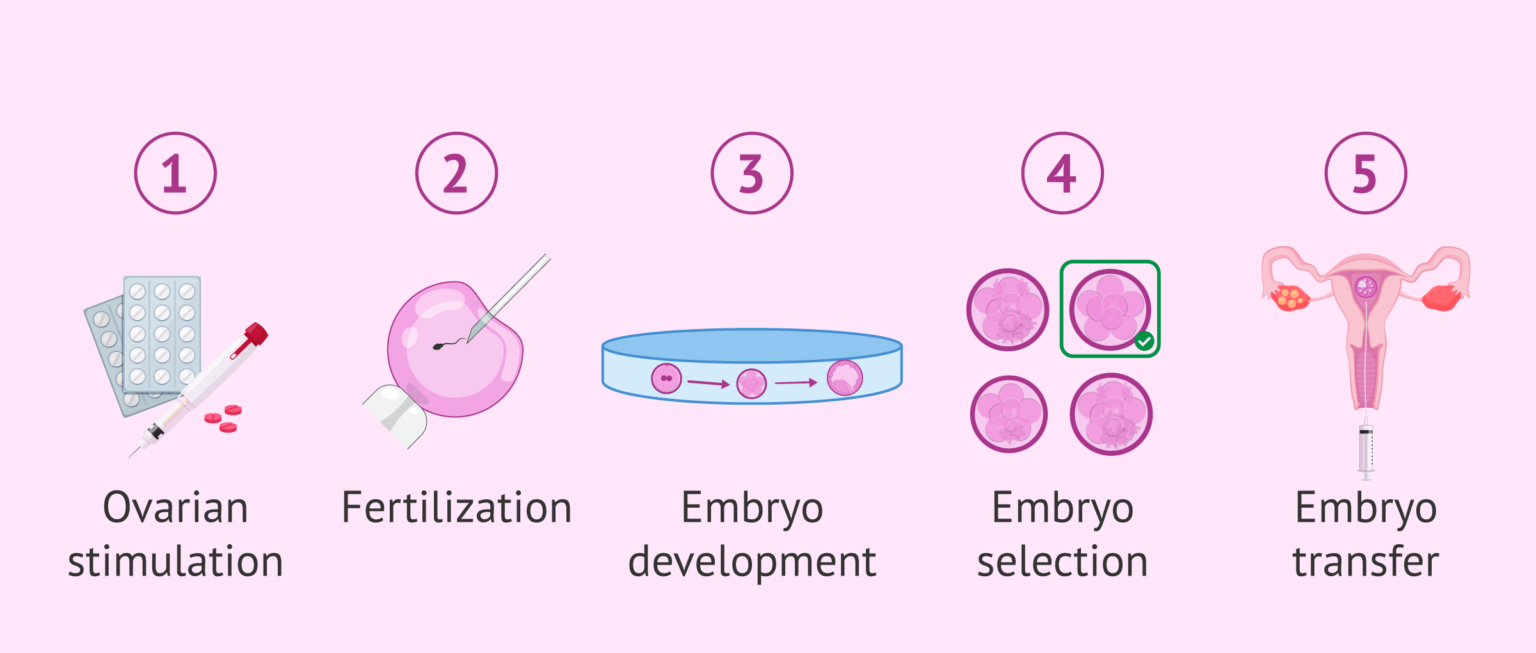 What are some of the main advantages of in vitro fertilization?
