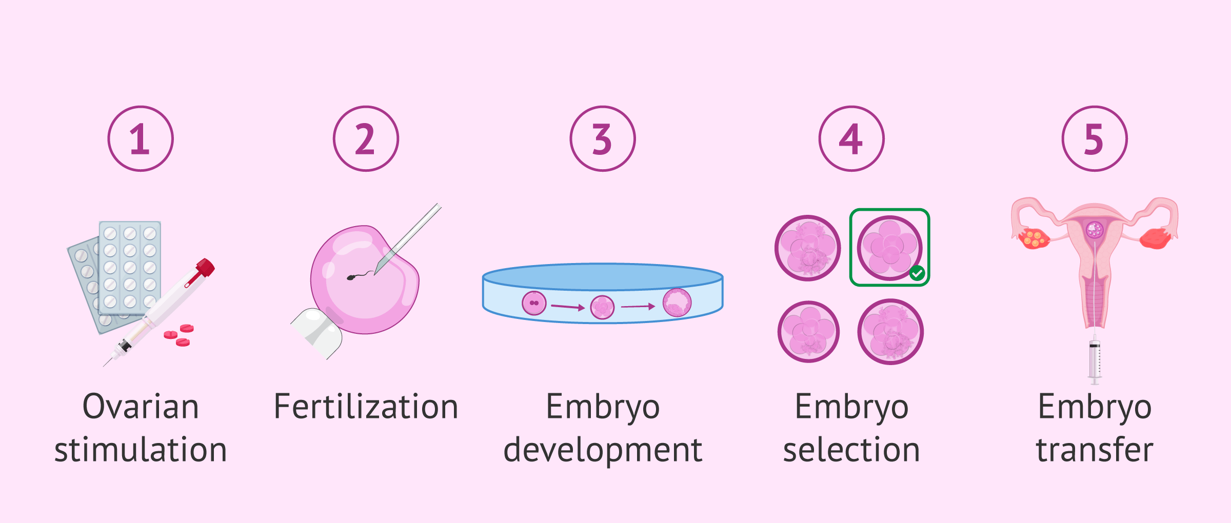 Advantages in the IVF process