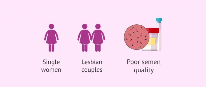 Imagen: When is AI with donor sperm performed?