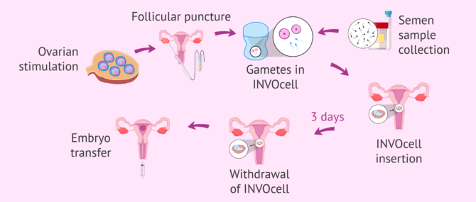 Imagen: INVO Process