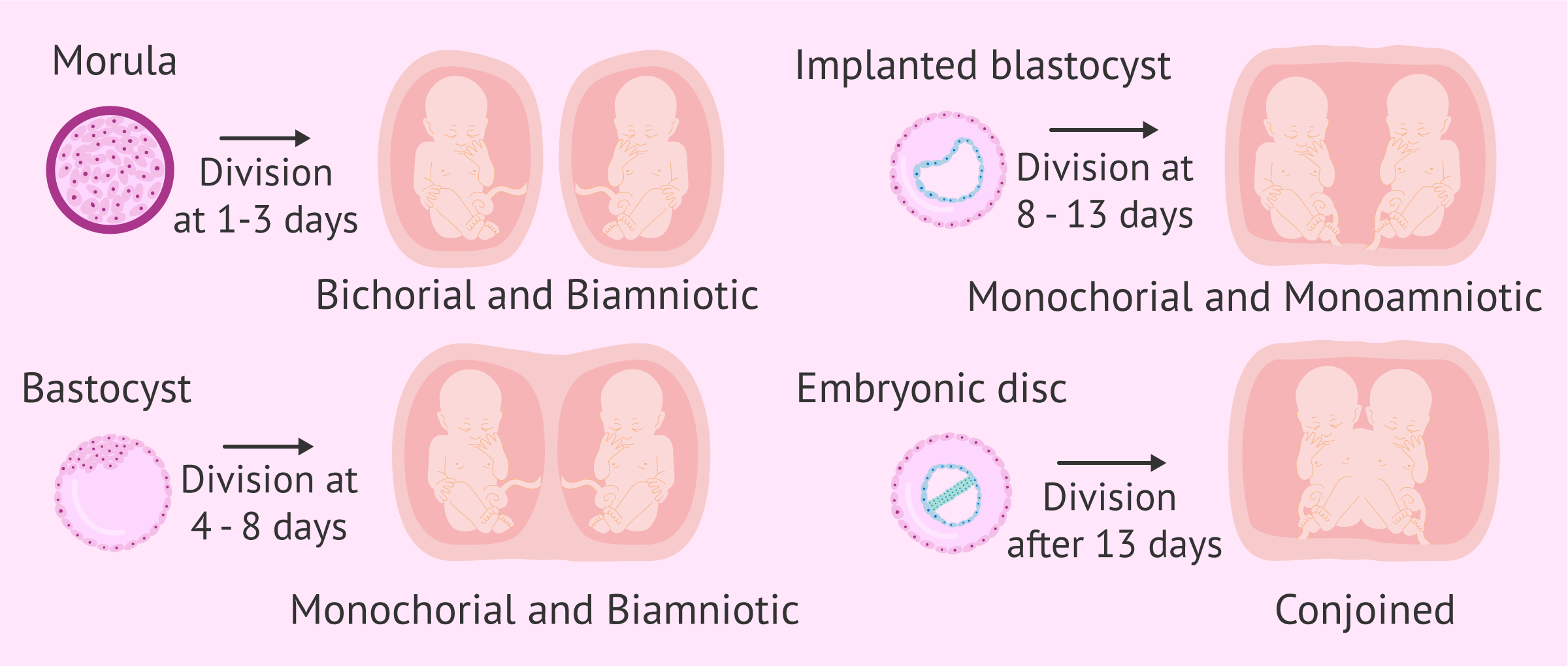 Types of monozygotic twins