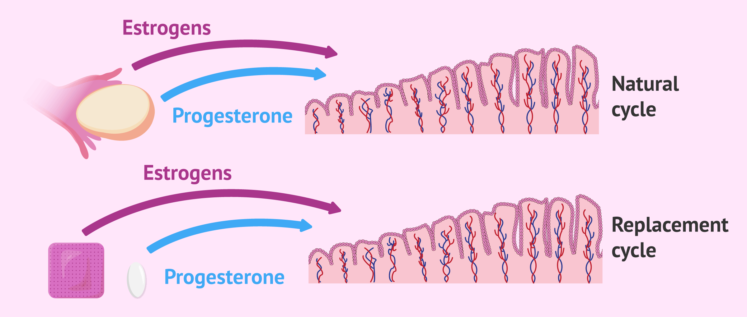 Post transferencia embrionaria