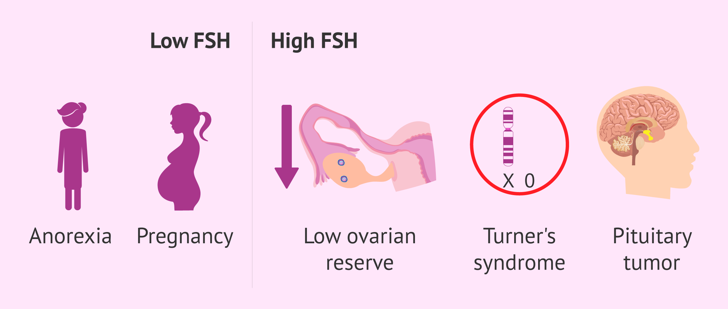 Imagen: Alterations of FSH values in women