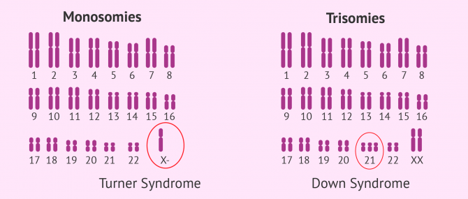 Aneuploidies and life expectancy
