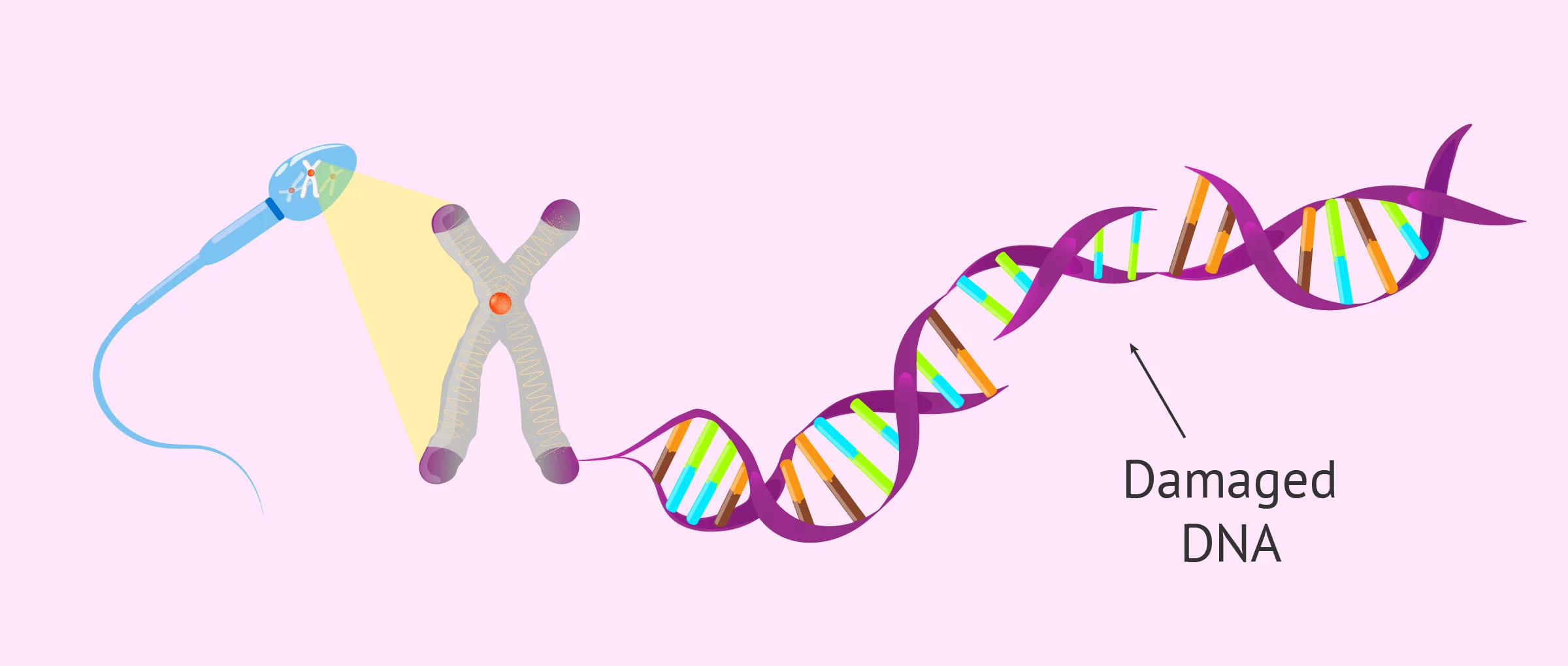 Sperm DNA Fragmentation - Causes & Effect on Fertility