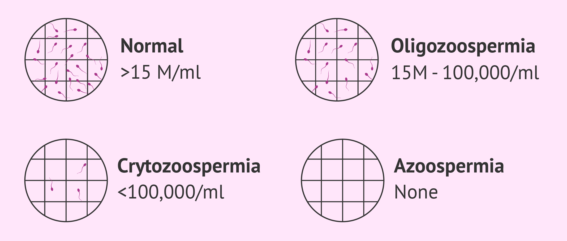 Varicocele - Causes, Symptoms & Treatment