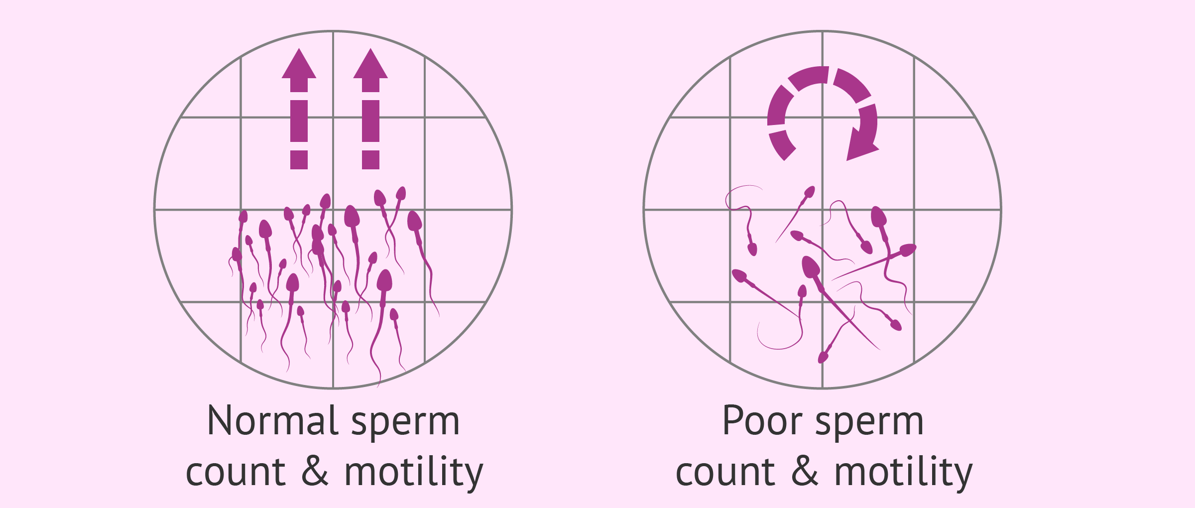 Motility Range Chart