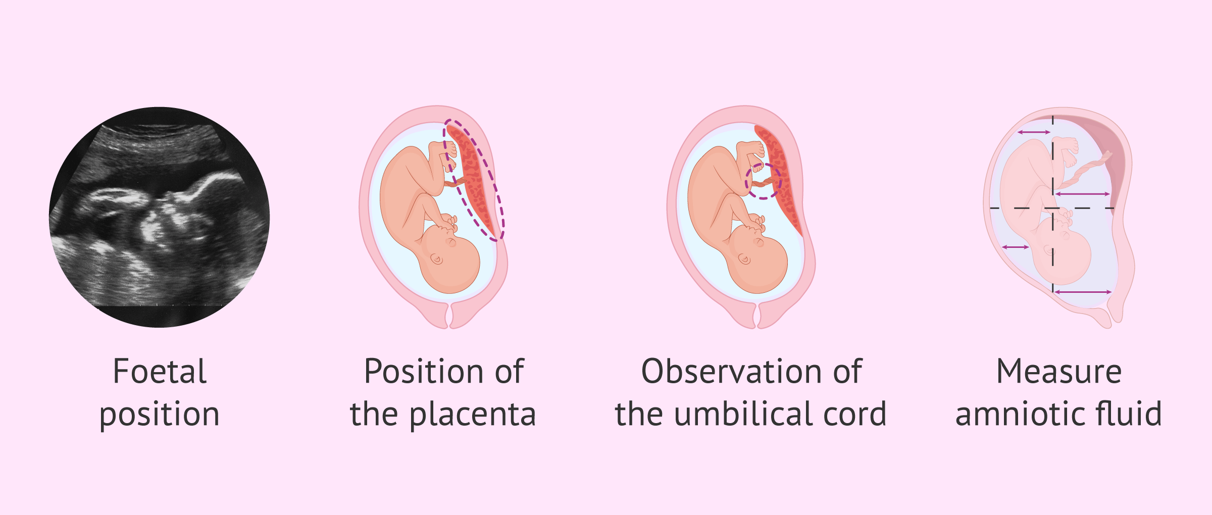 Fetal ultrasound in the third trimester of pregnancy