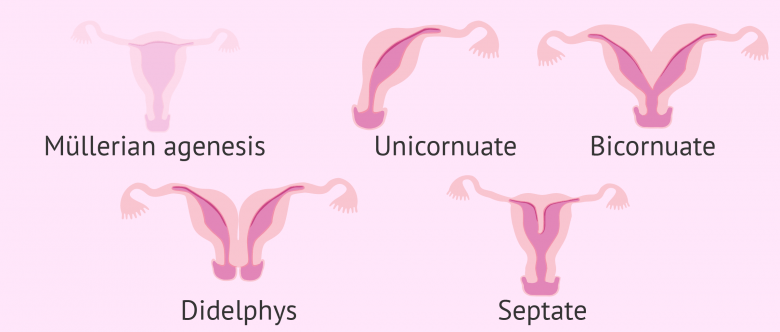 Picture of Image result for hysterectomy genetic testing for women
