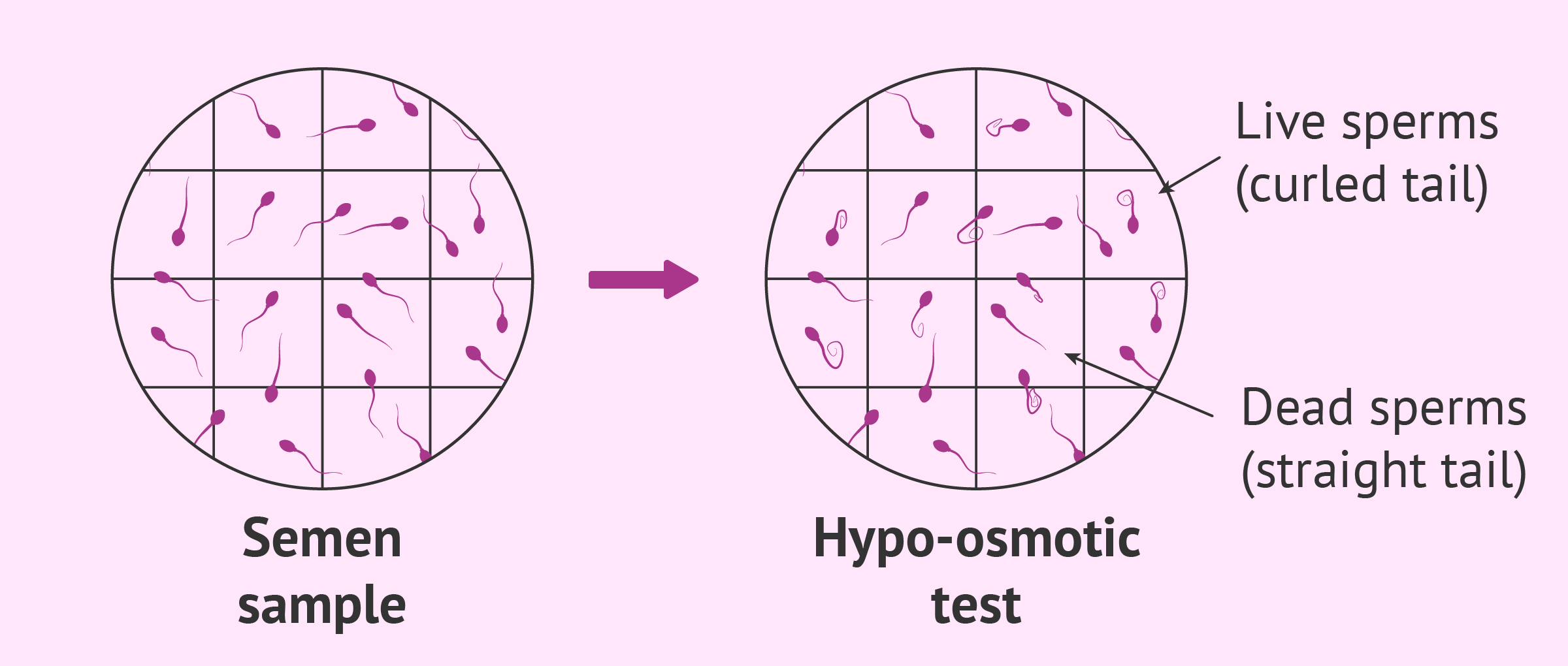 Necrospermia detection with a hypo-osmotic swelling test