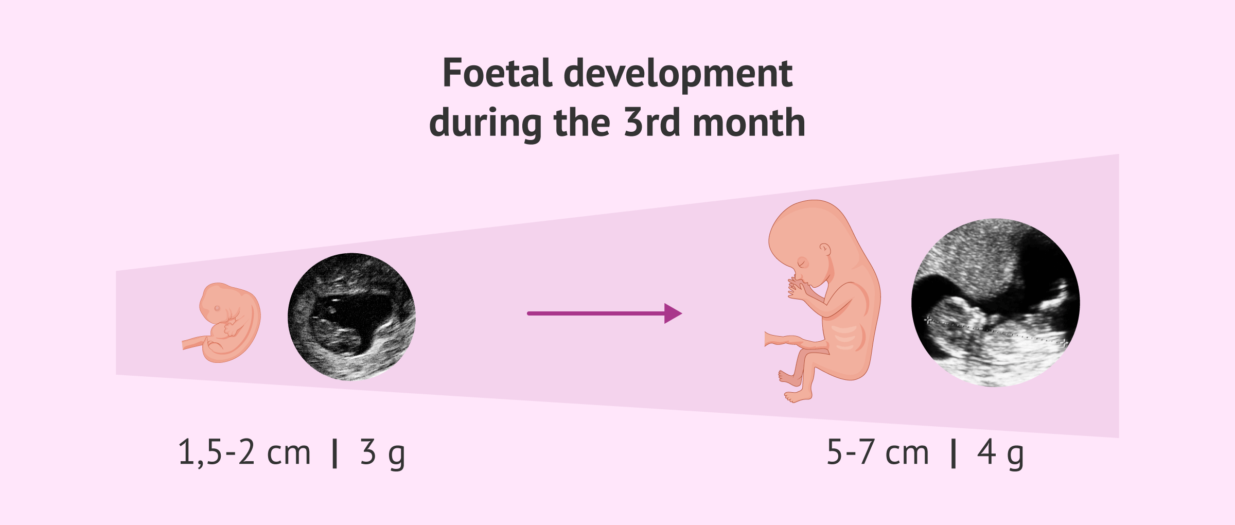 3 Months of Pregnancy