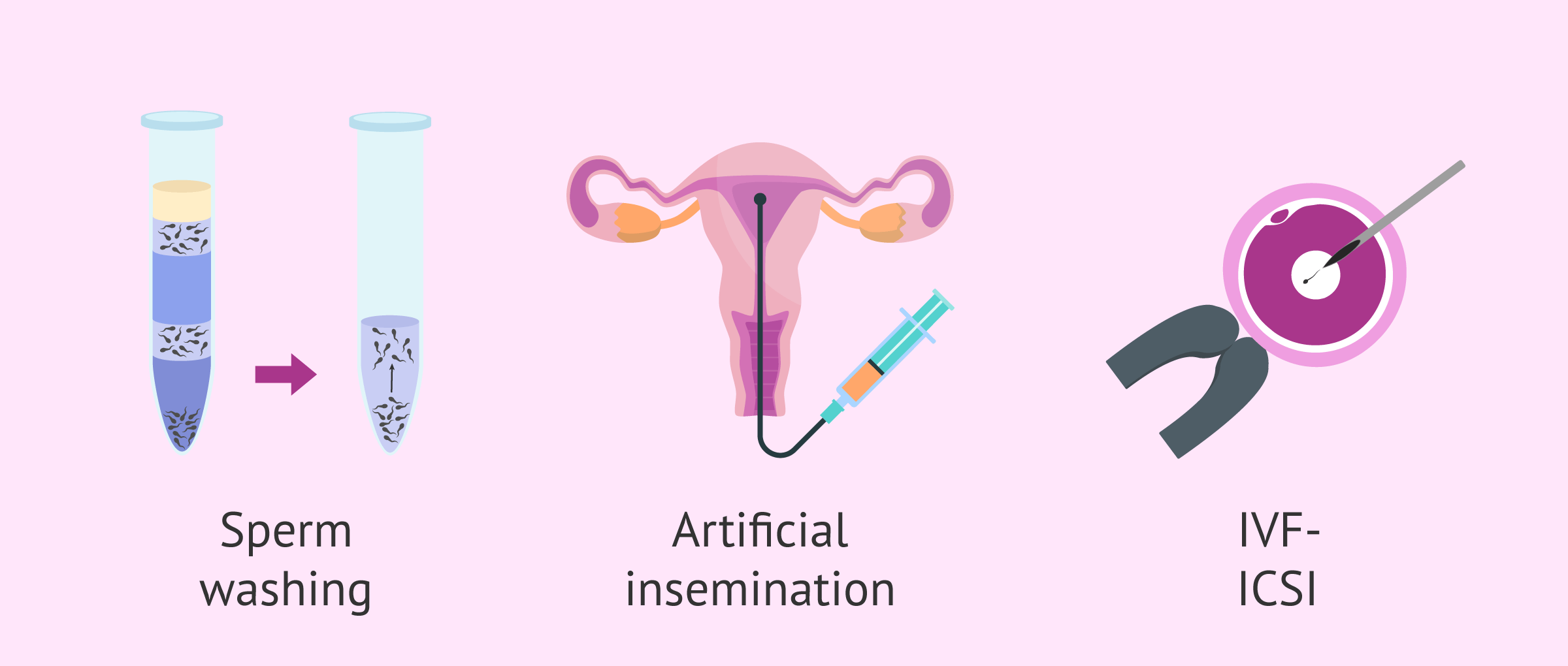 Recomendaciones antes y despues de una inseminacion artificial
