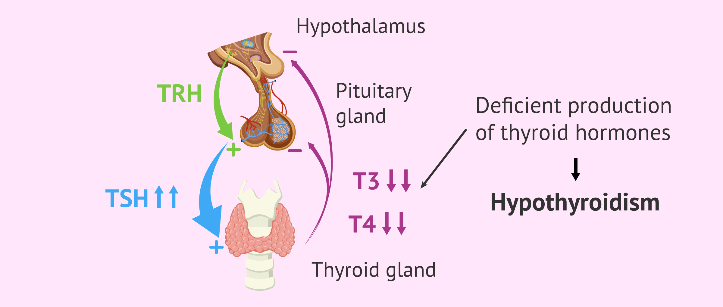 Hypothyroidism and TSH levels