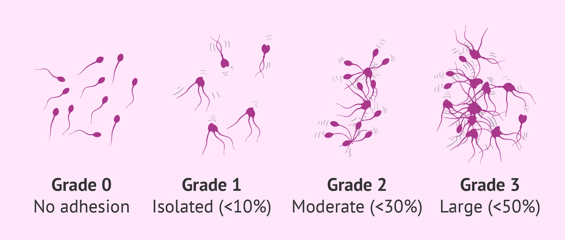 What Is Agglutination In Sperm Causes Symptoms Treatment