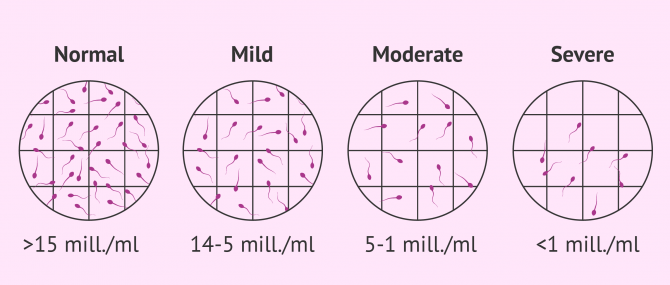 Achieving prenancy with oligozoospermia