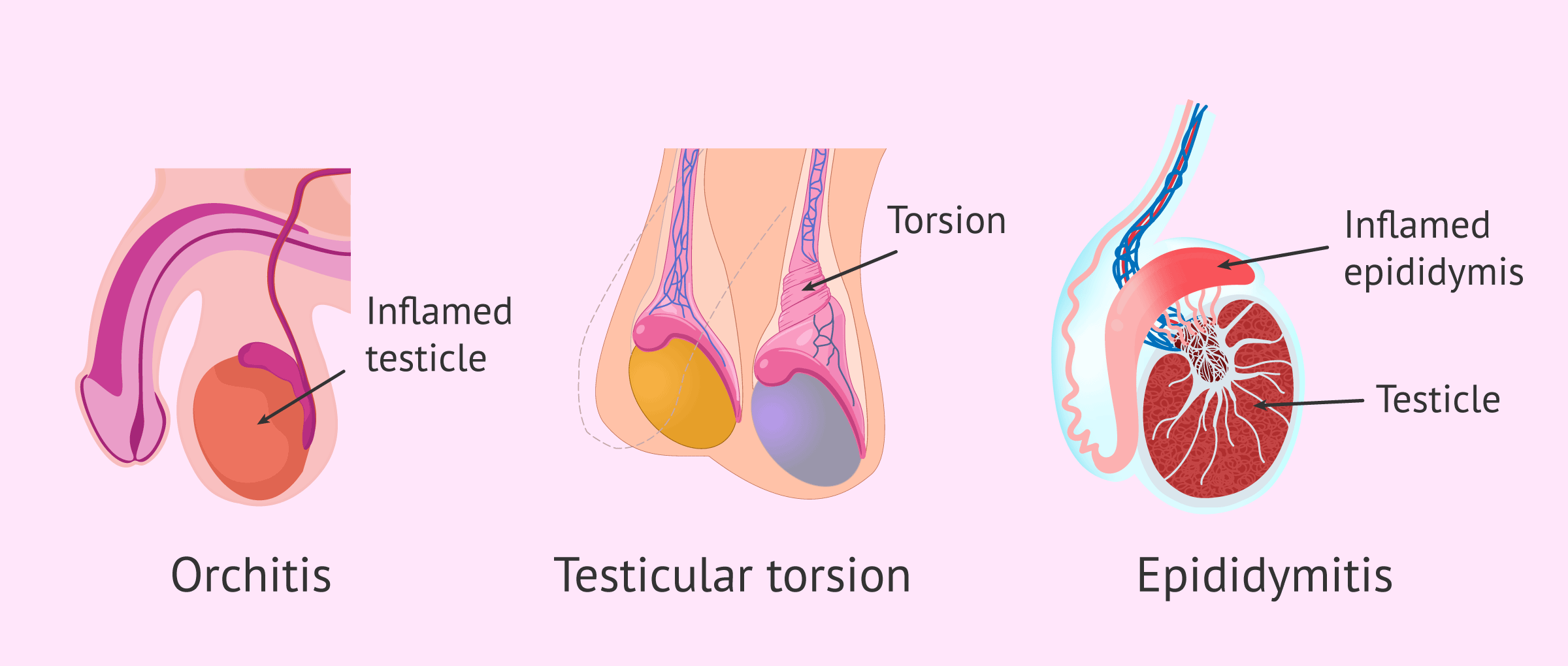 Kicked in the Balls: Damage, Recovery, and Pain Explained