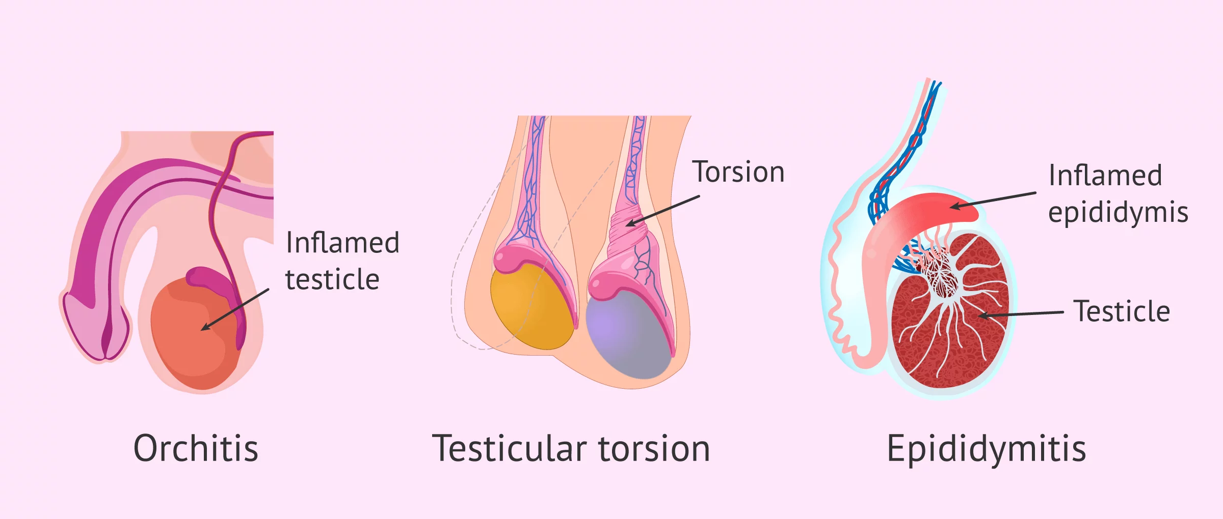 Consequences of a kick in the testicle
