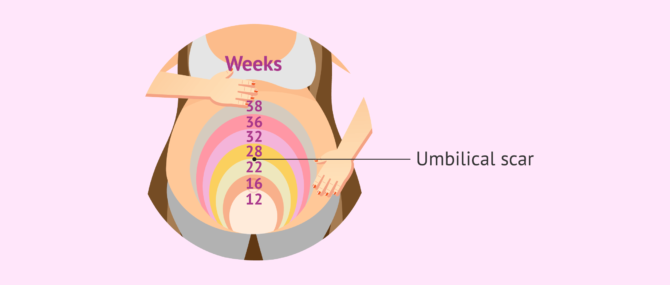 Imagen: Glucose test during pregnancy