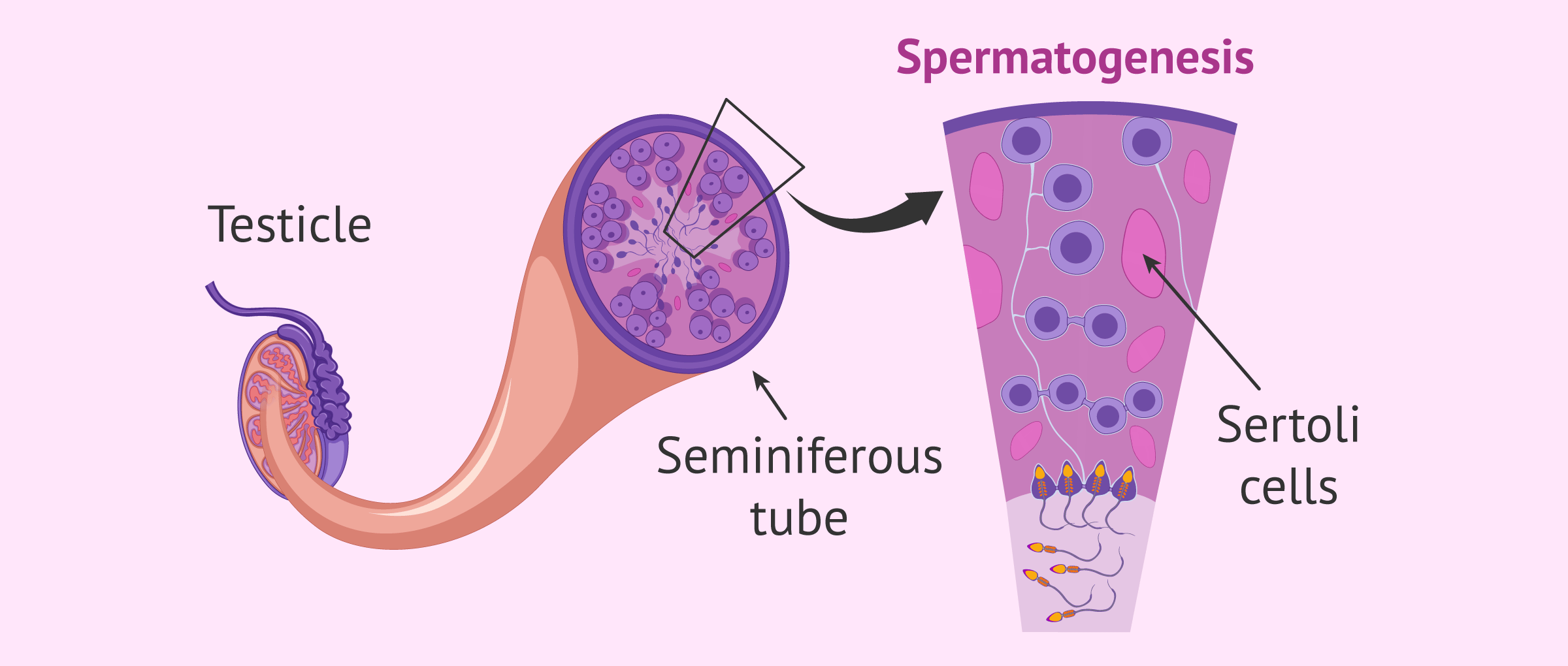 What is Sertoli syndrome? - Causes and possible treatment