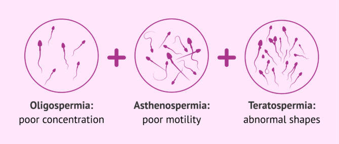 How to treat and achieve pregnancy with oligoasthenoteratospermia